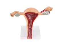 Supkan ccessoires médicaux pathologiques d'utérus pathologique modèle ovaire Anatomique Anatomie pathologie lésion médicale