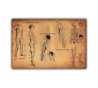 Supkan ffiche de Points d'acupuncture Humaine Science et éducation médecine décoration la Maison Affiche Photo Impression(40x60 cm)