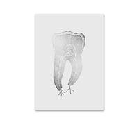 Supkan natomie Dentaire orthodontiste médecine orale molaire Mur Art Toile Peinture Nordique Affiche et Imprime des Images for la décoration de Salle Clinique(1,60x80 cm No Frame)