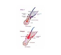 Supkan natomie des Cheveux Art physiologie Affiche et Impression épilation cosmétologue Cadeau Toile Peinture Mur Photo beauté Chambre décor(C,10X15 cm Unframed)