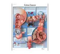 Supkan natomie Humaine Organes Soie Affiches Et Gravures Imprimé Peinture Anatomique Tableau Mur Art Photos for Clinique Salle De cor(124)