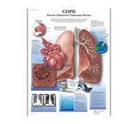 Supkan natomie Humaine Organes Soie Affiches Et Gravures Imprimé Peinture Anatomique Tableau Mur Art Photos for Clinique Salle De cor(123)