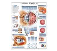 Supkan harts anatomiques Charte de Dents humaines Peinture APPIRONNÉ(Jy1437,60x80cm no Frame)