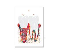 Supkan ents Accolades Anatomie Soins Dentaires Symbole Dent Racine Aquarelle Affiche Toile Peinture Mur Photo Art Prints Décor Dentaire(Picture 7,13x18cm No Frame)