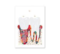 Supkan e des Dents médecine orale Anatomie molaire Art Mural Toile Peinture Affiches et Impressions Nordiques Photos murales for décor de Clinique Dentaire(E,50X70cm No Framed)