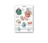 Supkancl Maladies humaines de l'oeil Tableau Affiches réfractive Toile Impression Mur Photos for l'éducation médicale hôpital décor à la Maison(3,20X30cm unframed)