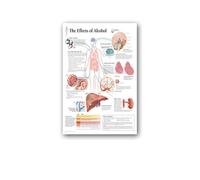 Supkancl Maladies humaines de l'oeil Tableau Affiches réfractive Toile Impression Mur Photos for l'éducation médicale hôpital décor à la Maison(2,20X25cm unframed)