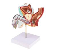 Supkancl Modèle de pathologie reproductive Interne maladie la Reproduction Masculine Anatomique
