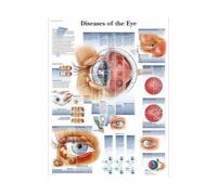 Supkancl Système des Muscles d'anatomie Humaine Affiche imprimé cartographie du Corps en Soie Peinture Murale Images for l'éducation médicale Office Home Decor(Eye,44x33cm No Frame)