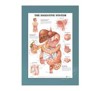 Supkancl Toile Affiche Moderne décor à la Maison Maladies de l'oeil Impression Peinture Mur Art éducation médicale Image modulaire for Salon(12,45x60cm No Frame)