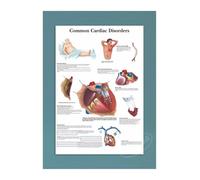 Supkancl Toile Affiche Moderne décor à la Maison Maladies de l'oeil Impression Peinture Mur Art éducation médicale Image modulaire for Salon(16,30x42cm No Frame)