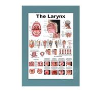 Supkancl Toile Affiche Moderne décor à la Maison Maladies de l'oeil Impression Peinture Mur Art éducation médicale Image modulaire for Salon(15,38x50cm No Frame)