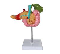 Supkancl Vie-Life 1: 1 Pancréas Humain du duodénum BLADIER PATHOLOGIQUE MODÈLE Anatomique Anatomie Modèle Squelette