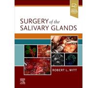 Surgery of the Salivary Glands