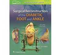 Surgical Reconstruction Of The Diabetic Foot And Ankle