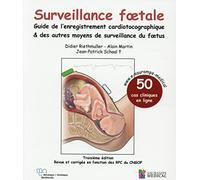 SURVEILLANCE FOETALE - GUIDE DE L'ENREGISTREMENT CARDIOTOCOGRAPHIQUE & AUTRES MO