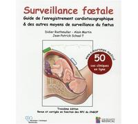 Surveillance foetale - guide de l'enregistrement cardiotocographique & autres mo Guide de l'enregistrement cardiotocographique et des autres moyens de surveillance du foetus - Didier Riethmuller - Sau