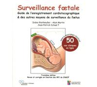 SURVEILLANCE FOETALE - GUIDE DE L'ENREGISTREMENT CARDIOTOCOGRAPHIQUE & AUTRES MO