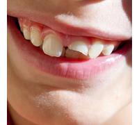 Swimming Paul - Smiling Through the Pain