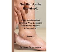 Swollen Joints Explained.: Understanding Joint Swelling, Inflammation, and What It Means. Book 5.