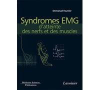 Syndromes EMG d'atteinte des nerfs et des muscles (volume 4)
