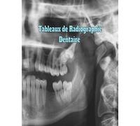 Tableaux de Radiographie Dentaire