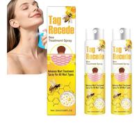 Tag Recede Spray, Élimination des verrices, Amélioration de la granulation et des moisissures, peau lisse,Convient à Tous Les Types De Peau, 20ml (2)