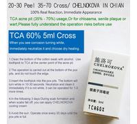 Tca Pure Tca Peel Solution Pour Les Dommages Causés Par Le Soleil,Les Ridules Déforment Le Teint Irrégulier De La Peau,Le Fuchsia Agrandi - Type 5ml Tca 60