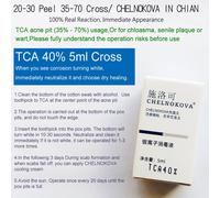 Tca Pure Tca Peel Solution Pour Les Dommages Causés Par Le Soleil,Les Ridules Déforment Le Teint Irrégulier De La Peau,Le Fuchsia Agrandi - Type 5ml Tca 40