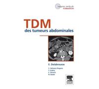 TDM des tumeurs abdominales