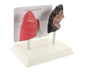 TEMPNAP Modèle D'anatomie Pulmonaire en Pvc Réaliste et Éducatif pour Étudiants, Comparaison des Poumons Sains Fumeurs, pour Enseignement Physiologie