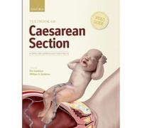 Textbook of Caesarean Section - [Version Originale] Inconnu (Auteur)