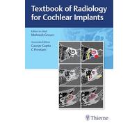 Manuel de radiologie pour implants cochléaires – Thieme