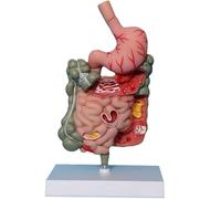 TGPSMDXKV Modèle Anatomique de l'estomac Humain Modèle pathologique du système digestif, modèle pédagogique démontable, Section de l'estomac et du Petit intestin Modèle médical