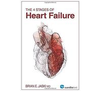 The 4 Stages Of Heart Failure