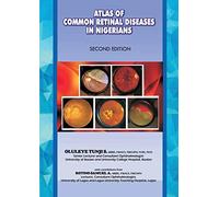 The Atlas Of Retinal Diseases In Nigerians