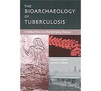 The Bioarchaeology of Tuberculosis Charlotte Roberts, Jane E. Buikstra (Auteur)