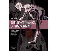 The Biomechanics of Back Pain