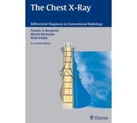 The Chest X-Ray