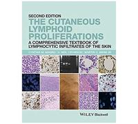 The Cutaneous Lymphoid Proliferations