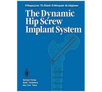 The Dynamic Hip Screw Implant System