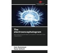 The electroencephalogram: Neurophysiological bases, principles of realization and interpretation