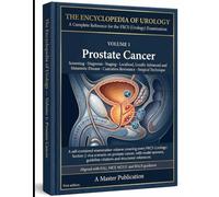 THE ENCYCLOPEDIA OF UROLOGY - VOLUME 1 Prostate Cancer