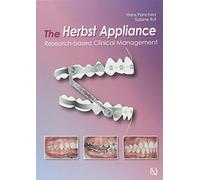 The Herbst Appliance: Research-based Clinical Management
