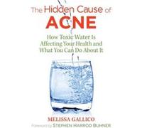 The Hidden Cause of Acne: How Toxic Water Is Affecting Your Health and What You Can Do about It - [Version Originale] Inconnu (Auteur)
