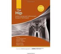 The Hip: Aana Advanced Arthroscopic Surgical Techniques J W Thomas Byrd Md (Auteur)