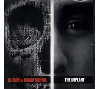 The Implant