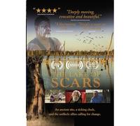 The Lake Of Scars