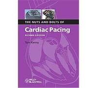The Nuts and Bolts of Cardiac Pacing Tom Kenny (Auteur)