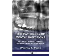 The Pathology Of Dental Infections
